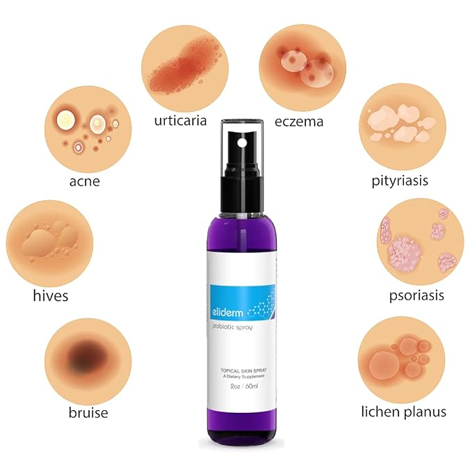 Topical Probiotic Spray For Skin - 13 Strains Live Probiotic Skin Care Dermatic Biome Acne Folliculitis Supplement Dermatitis Rosacea Eczema Treatment Body Face Mist Sprayable Deodorant Microbiome